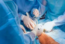 جراحی افزایش قد؛ معجزه یا شکنجه مدرن؟